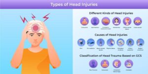 Head Trauma and Extreme Violence: How Viral Games Run It Straight and Power Slap Are Regressing Sports Safety