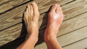 Aussie Sprint Sensation Shatters Records with Unbelievable Gout Performance!